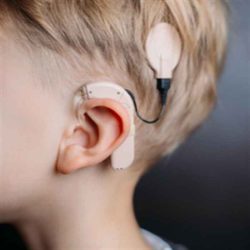 Cochlear implant implants